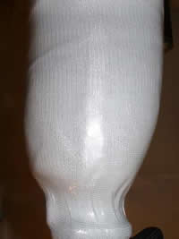 Farabloc Lamination for Phantom Pain Relief