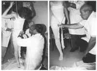 Hip Disarticulation Techniques Image