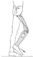 Hip Disarticulation Techniques Image