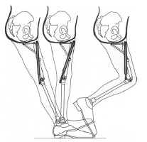 Hip Disarticulation Techniques Image