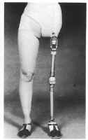 Hip Disarticulation Techniques Image